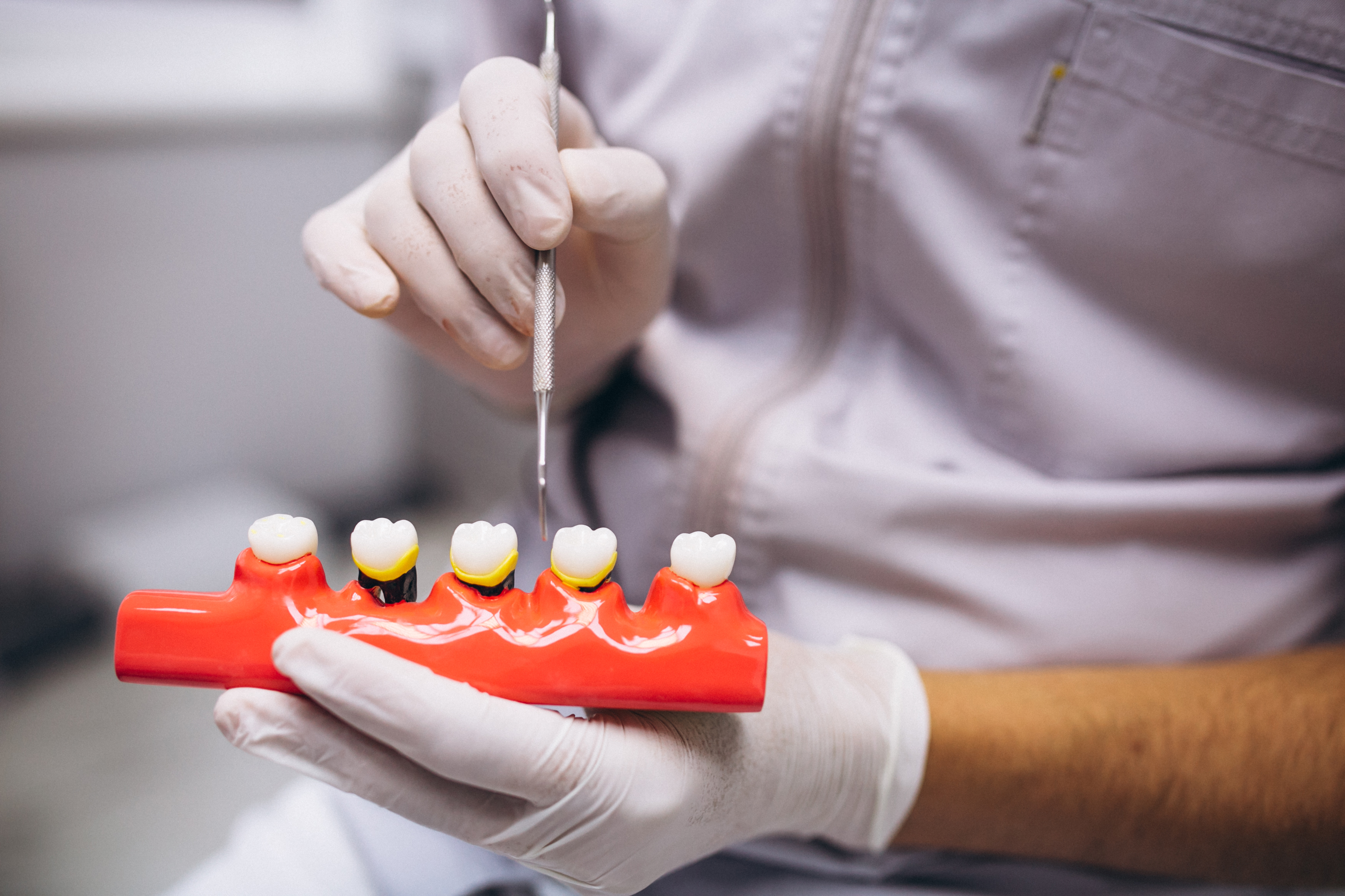 Gingivitis and Periodontitis